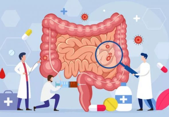 Probiotics
